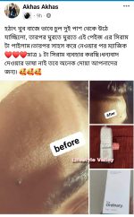 The Ordinary Multi-Peptide Serum for Hair Density - 60 ml with Derma Roller - Image 3