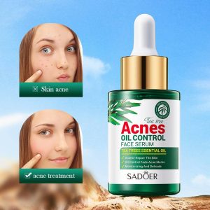 Sadoer Tea Tree Oil Control Anti-Acne Serum Essence -30ml